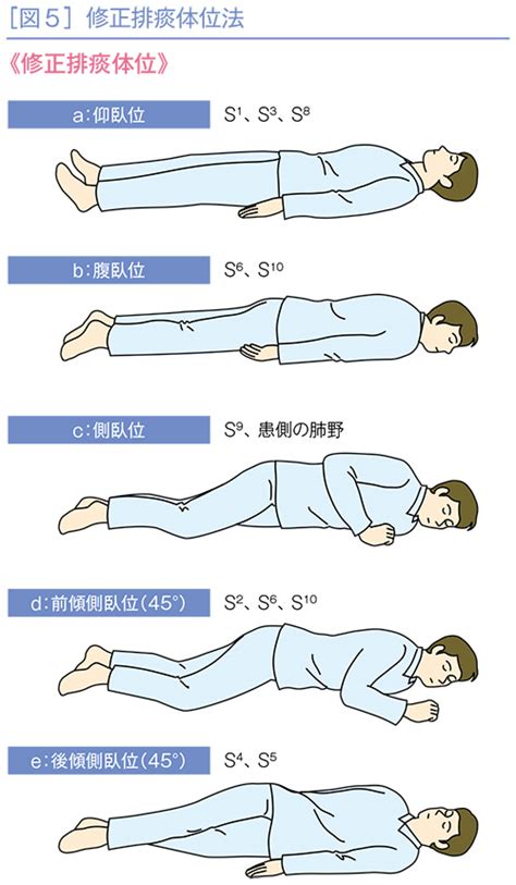 左前傾側臥位|前傾側臥位